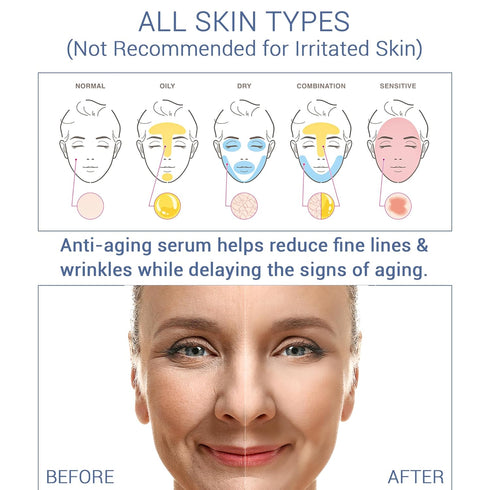 Niacinamide with Hyaluronic Acid Vitamin C Serum For Face, Amino Acid Facial Serum, All Skin Types & Skincare Hydrating, Oil-Free Moisturizing, 1 ...
