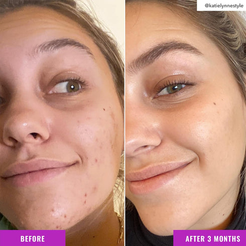 Good Molecules Niacinamide Brightening Toner - Facial Toner with Niacinamide, Vitamin C and Arbutin for Even Tone, Enlarged Pores - Skincare for F...