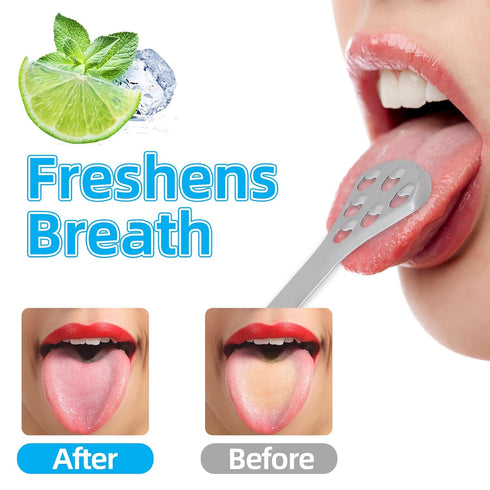 2-Piece Tongue Scraper for Adults, Metal Tongue Scrapers for Oral Care, Professional Tongue Cleaner for Tongue Care, Reduce Bad Breath and Fresh B...
