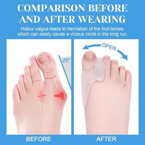 Pack of 6 Bunion Cushion Protector,Reusable Bunion Pads with Separator for Big Toe, Gel Shield,Toe Spacers for Foot Pain Relief,Yoga Toes,Bunion S...