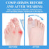 Pack of 6 Bunion Cushion Protector,Reusable Bunion Pads with Separator for Big Toe, Gel Shield,Toe Spacers for Foot Pain Relief,Yoga Toes,Bunion S...