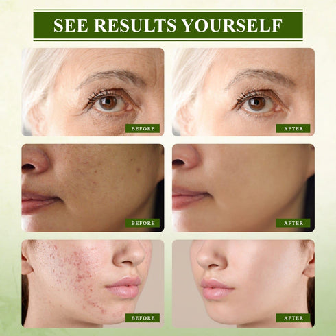 VoilaVe Topical Skin Spray, Pack of 3 - Hydrate, Nourish, and Rejuvenate, Enhance Your Skincare Routine with Hypochlorous Acid Spray, Advanced For...