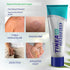 Tinea Versicolor Treatment Antifungal Cream: Extra Strength Natural Anti Fungal Anti Itch - for Tinea Versicolor Ringworm Athlete's Foot Jock Itch...