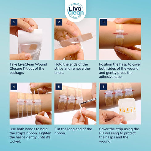 (3 CT) 1 X 3.7” Wound Closure Strips - Zip Stitch Wound Closure Kit - Butterfly Kit Device Zip Tie Skin Closuing Butterfly Bandaids Adhesive Injur...