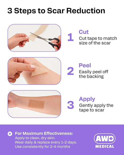 AWD Silicone Scar Sheets for Surgical Scars - Seamless Medical Grade Silicone Scar Tape for C Section, Tummy Tuck Tape - Silicone Skin Patches Aft...