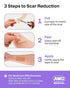 AWD Silicone Scar Sheets for Surgical Scars - Seamless Medical Grade Silicone Scar Tape for C Section, Tummy Tuck Tape - Silicone Skin Patches Aft...