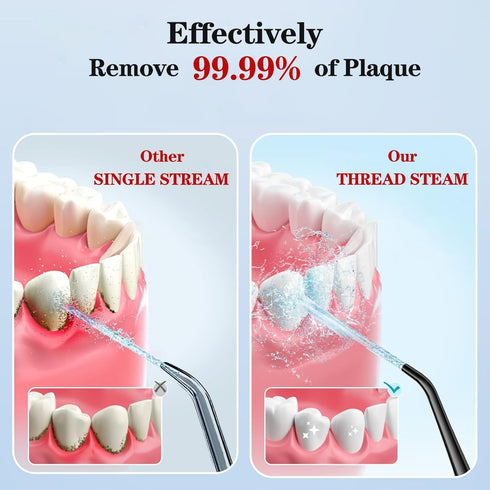 Oral Irrigator Portable Water Flosser Professional Water Dental Flosser Teeth Pick,Gums, Braces Care Irrigator Water Jet for Teeth Braces Care wit...