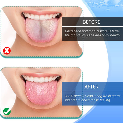 4PCS Tongue Scraper, Stainless Steel Tongue Cleaners, 100% BPA Free Fresher Tongue Tools, Healthy Oral Hygiene Brushes, Medical Grade Reusable Sta...