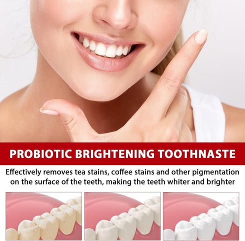 Sp-6 Ultra Whitening, Sp-6 Probiotic Whitening Toothpaste, Ultra Whitening Toothpaste sp6, Probiotic Brightening Toothpaste,Deep Cleaning Care Too...
