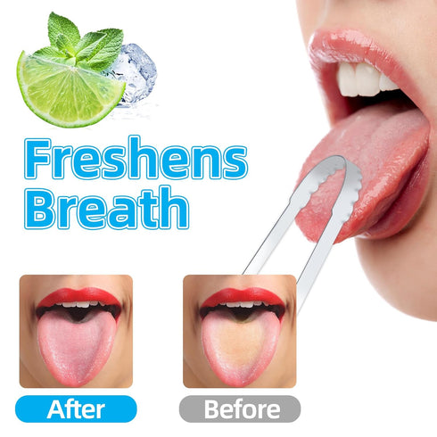 Tongue Scraper for Adults, Metal Tongue Scrapers with Green Silicon Handle for Oral Care, Professional Tongue Cleaner for Tongue Care, Reduce Bad ...