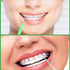 Zopeal 250 Pieces Braces Flossers Interdental Brush for Cleaner Tooth Toothpick Dental Teeth Flossing Head Oral Dental Hygiene Cleaning Tool Soft ...