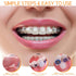 30 Pack Colorful Braces Wax Dental Care Orthodontic Wax for Braces Wearer (10 Color)...