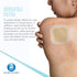 Dynarex DynaDerm Hydrocolloid Dressing, Sterile Moist Bandages Used for All Kinds of Wound, 2" x 2", Thin and Latex-Free, Pack of 20...