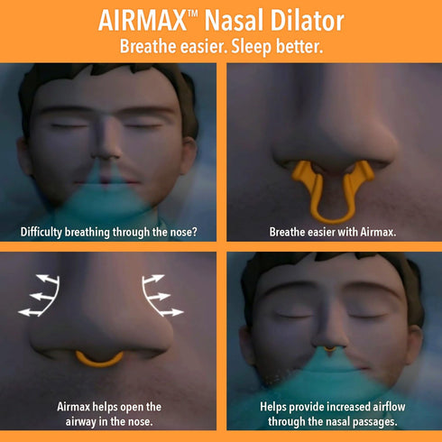 AIRMAX Nasal Dilator for Better Sleep - Natural, Comfortable, Anti Snoring Device, Snoring Solution for Maximum Airflow and Easier Breathing (Medi...