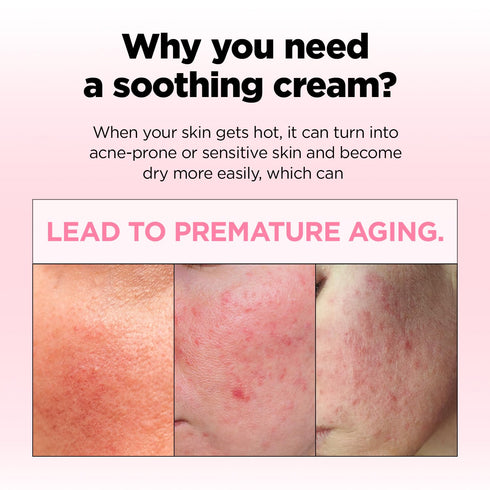 FARMSKIN Pink Vera Soothing Cream (100ml, 3.38oz) - Korean Skincare Moisturizer for Face & Body/Aloe Vera for Sunburn Relief/Non-Greasy/Korean Ski...