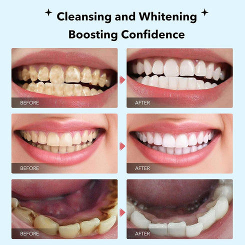 SP-6 Ultra Probiotics Whitening Toothpastes, Deep Cleansing for Coffee Stain, Tea Stain, Wine Stain, Bad Breath, Oral PH Balance-1 Pack...