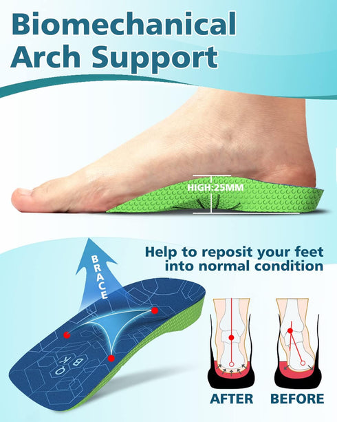 Achilles Tendonitis Relief, QBK Metatarsalgia Insole for Plantar Fasciitis, O/X-Legs, Flat Feet, Overpronation, Heel Spurs, Men & Women Daily Use ...