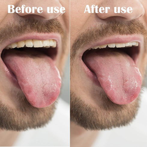 Crafts Idea Stainless Steel Tongue Cleaner...