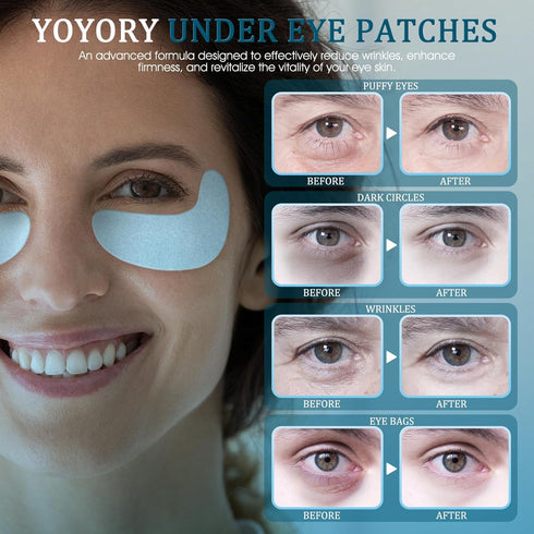 Under Eye Patches Masks - for Dark Circles, Wrinkles, Puffy Eyes, Fine Lines, Eye Bags Treatment with Hyaluronic Acid and Collagen, Hydrating and ...