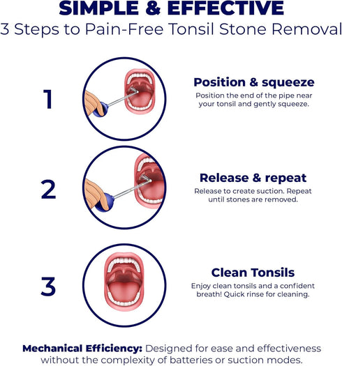 Oravix Tonsil Stone Vacuum, Tonsil Stone Remover Vacuum Suction, Tonsil Stone Cupping Tool, Tonsil Stone Removal Tool with Suction, Tonsil Stones ...