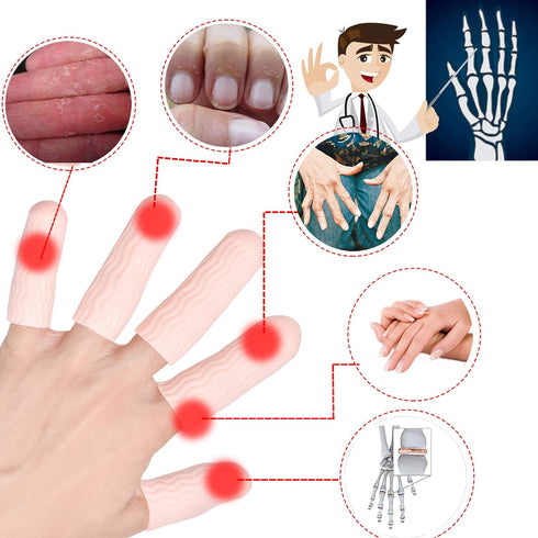 Finger Cots, Gel Finger Tips Protector, Finger Covers (14PCS, L size), New Material (Latex-Free), Finger Sleeves Great for Finger Cracking, Dermat...
