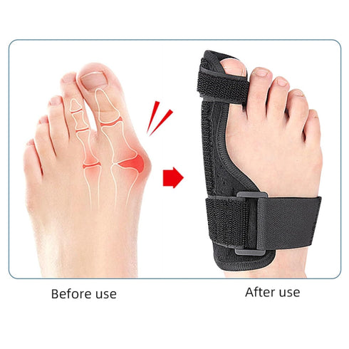 Bunion Corrector Big Toe Straightener Hammer Toe Bunion Pain Relief Hallux Valgus Corrector Bunion Splint Bunion Pads Toe Brace Right+Left...