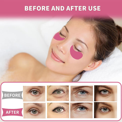 Under Eye Patches 70PCS, Peach Caviar Eye Patches for Puffy Eyes Treatment, Under Eye Masks for Dark Circles and Puffiness, Non-Irritating Eye Mas...