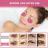 Under Eye Patches 70PCS, Peach Caviar Eye Patches for Puffy Eyes Treatment, Under Eye Masks for Dark Circles and Puffiness, Non-Irritating Eye Mas...