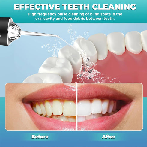 Oral Irrigator Portable Water Flosser Professional Water Dental Flosser Teeth Pick,Gums, Braces Care Irrigator Water Jet for Teeth Braces Care wit...