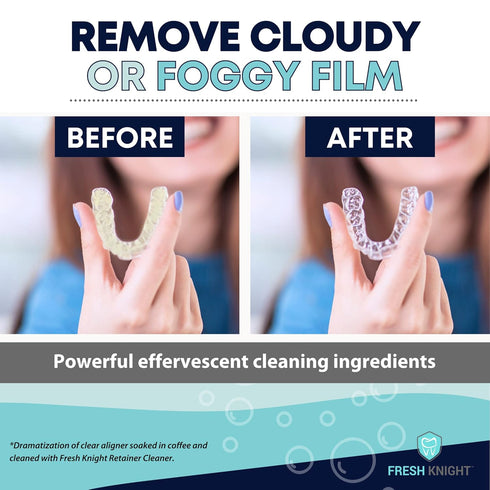Retainer Cleaner, Denture Cleaner (120 Tablets) Removes Cloudiness, Brightens and Freshens Clear Aligners, Retainers, Night Guards, Mouth Guards, ...