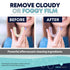 Retainer Cleaner, Denture Cleaner (120 Tablets) Removes Cloudiness, Brightens and Freshens Clear Aligners, Retainers, Night Guards, Mouth Guards, ...