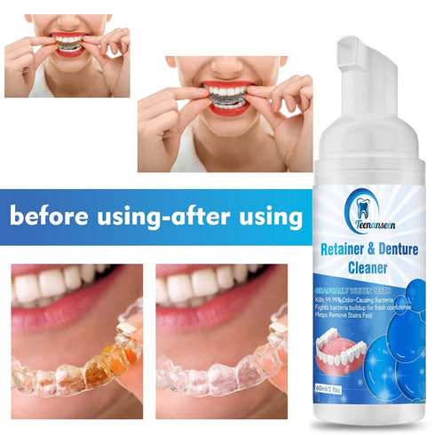 Aligner Cleaner, Denture Cleaner and Whitener Paste Foam Perfect for Sports Mouth Guard and Denture, Fast-Acting Alternative to Retainer Cleaner T...