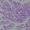 ZKC 4.5mm 10000PCS Purple Crystal Acrylic Diamond Vase Fillers Beads for Wedding Centerpiece Table Scatter Shower Party Vase Beads Decorations...
