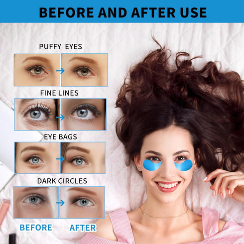 Under Eye Masks for Dark Circles and Puffiness 70PCS, Under Eye Patches for Puffy Eyes Treatment, Under Eye Gel Pads w/Collagen, Retinol, Hyaluron...