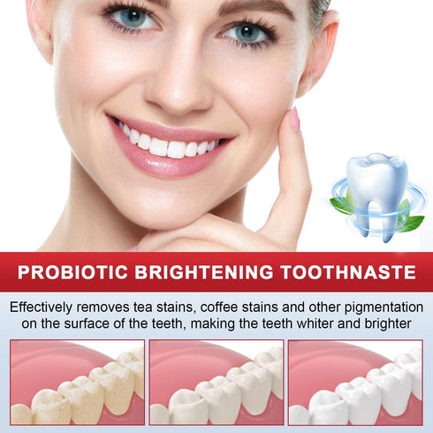 SP-8 Ultra Whitening Toothpaste,SP-8 Toothpaste, SP8 Probiotic Toothpaste, Probiotic Brightening Toothpaste, Ultra Whitening Toothpaste Sp-8, Deep...