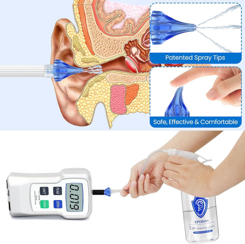 Ear Wax Removal Kit- Safe & Effective Ear Wash Kit w/ 500ml Ear Bottle, Comfortable 20 Reusable Tips, Big Basin & Drying Bulb - Easy to Use Ear Cl...