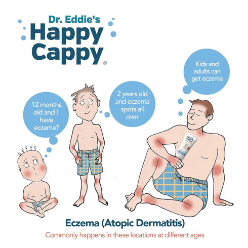 Happy Cappy Baby Shampoo and Body Wash - Shampoo & Body Wash for Eczema-Prone Skin, For Infants, Toddlers, & Kids, Reduces Itching and Redness, De...