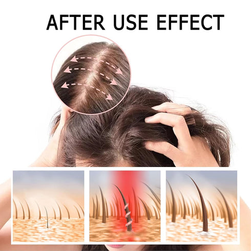 2 Box Ginger Plant Extract Anti-Hair Loss Hair Shampoo, Ginger Shampoo for Hair Growth Oil Control Hair Care Plant Shampoo for Women Men. (400g)...