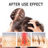 2 Box Ginger Plant Extract Anti-Hair Loss Hair Shampoo, Ginger Shampoo for Hair Growth Oil Control Hair Care Plant Shampoo for Women Men. (400g)...