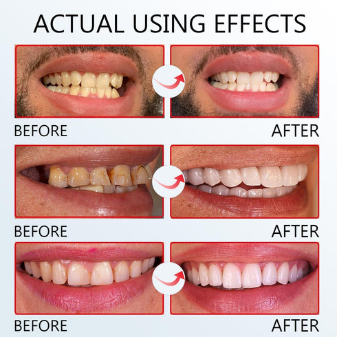 SP 8 Ultra Whitening Toothpaste,SP8 Probiotic Toothpaste, SP 8 Pasta De Dientes, SP 8 Toothpaste,Fresh Breath...