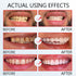 SP 8 Ultra Whitening Toothpaste,SP8 Probiotic Toothpaste, SP 8 Pasta De Dientes, SP 8 Toothpaste,Fresh Breath...