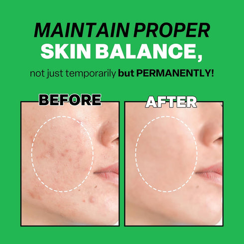 Mild Clear Toner Essence - Skin Moisturizing & Soothing Toner for Face, Tea Tree Facial Toner for All Skin Types | Hydrating Skin Toner, Daily Ski...