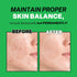 Mild Clear Toner Essence - Skin Moisturizing & Soothing Toner for Face, Tea Tree Facial Toner for All Skin Types | Hydrating Skin Toner, Daily Ski...
