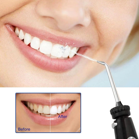Oral Hygiene Accessories Compatible with Waterpik WP-100, WP-900 Replacement Kit for Ultra Water Flosser, Pack of 1 Handle/Hose?Black?...