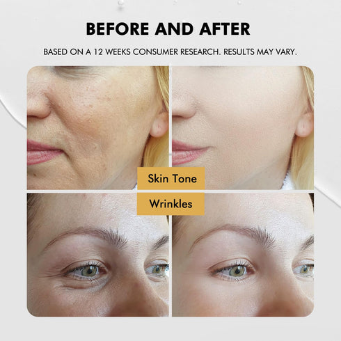 Snail Mucin Serum Skincare Moisturizer: Korean skin care for face - Advanced Snail Mucin power essence with 97% Snail Mucin Niacinamide Hyaluronic...