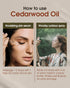 Cedarwood Essential Oil - 10 mL (1/3 oz) - Pure, Natural, Therapeutic Grade - for Diffuser, Massage, Stress Relief, Skin & Hair Care - Woody and E...