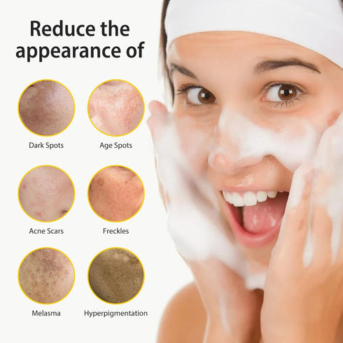 Tamoskiny Honey Glow Lemon Turmeric Kojic Acid Soap Bar for Hyperpigmentation, Lemon Turmeric Kojic Soap for Dark Spots Remover, Deep Cleansing Fa...