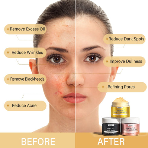 Turmeric Vitamin C Clay Mask, Dead Sea Mud Mask, and Himalayan Clay Mask, Facial Skin Care Set for Deep Pore Cleansing, Reduce Blackheads Acne, Da...