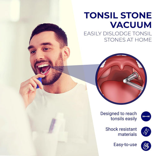 Oravix Tonsil Stone Vacuum, Tonsil Stone Remover Vacuum Suction, Tonsil Stone Cupping Tool, Tonsil Stone Removal Tool with Suction, Tonsil Stones ...