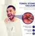 Oravix Tonsil Stone Vacuum, Tonsil Stone Remover Vacuum Suction, Tonsil Stone Cupping Tool, Tonsil Stone Removal Tool with Suction, Tonsil Stones ...